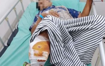 Petani Alami Luka Serius Saat Menyadap Karet Akibat Serangan Beruang di hutan Air Pohal OKU