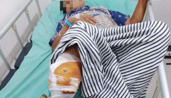 Petani Alami Luka Serius Saat Menyadap Karet Akibat Serangan Beruang di hutan Air Pohal OKU